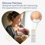 Silicone Scar Patches - Image 7